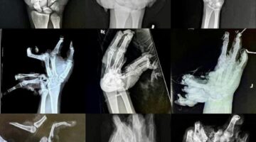 322489023_1112505435954424_356965132796233813_n